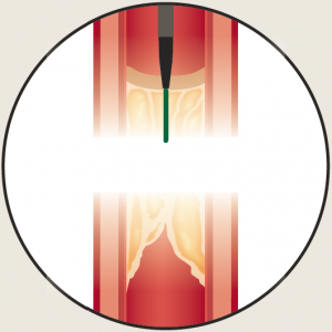 ambiguous-cto-drilling