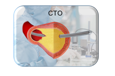 Asahi Chronic Occlusion GUIDE WIRES