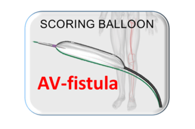 Scoring Balloon, Scoreflex AV-FISTULA