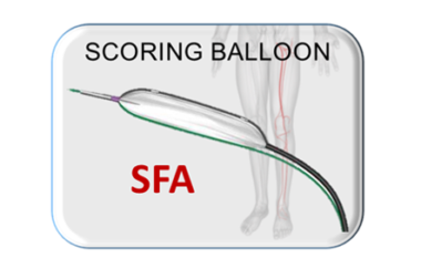 Scoring Balloon, Scoreflex SFA