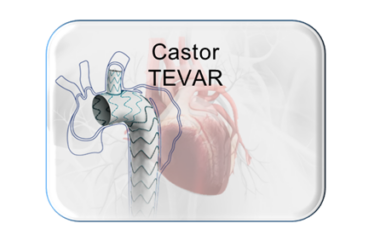 Castor, Branched Thoracic Stent-Graft System