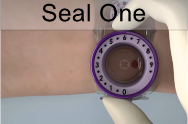 SEAL ONE – Radial Compression Device