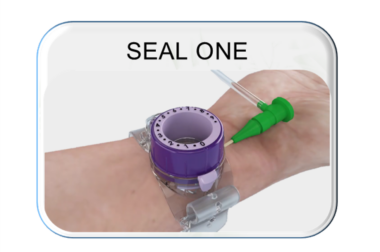 SEAL ONE – Radial Compression Device