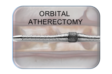 Diamond Back 360 – Orbital Atherectomy