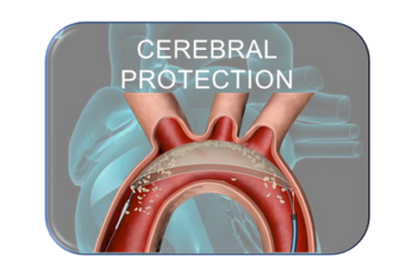 TRI Guard Cerebral Embolic Protection